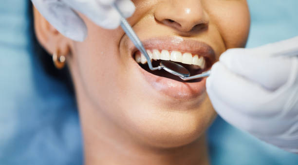 Best Urgent Dental Care for Toothaches in Bassett, VA