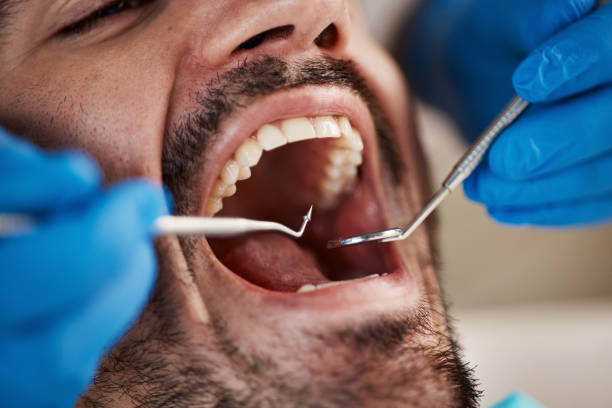 Best Walk-In Emergency Dental Services in Bassett, VA